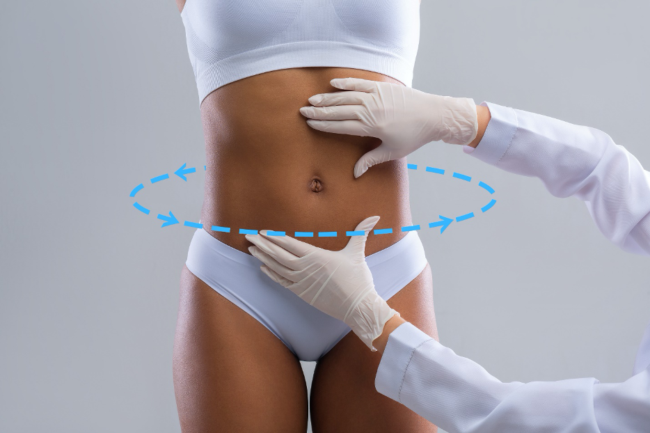 Reverse Tummy Tuck in Chicago IL  Reverse Abdominoplasty Chicago IL